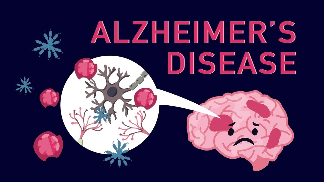 AIIMS Develops Blood Test for Early Alzheimers Detection